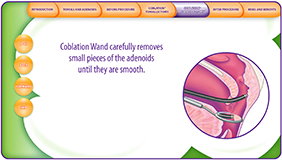 Your Child's Tonsillectomy Interactive Instructional Presentation